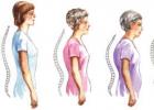 Основные упражнения от холки на шее
